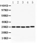 Anti-sCD40L Antibody