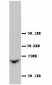 Anti-GJB2 Antibody