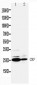 Anti-CRP Antibody