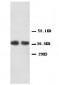 Anti-CXCR2 Antibody