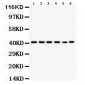 Anti-CXCR2 Antibody