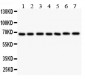 Anti-GAD67 Antibody