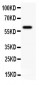 Anti-KCNN4 Antibody