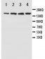 Anti-NMDAR2B Antibody