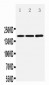 Anti-NMDAR2B Antibody