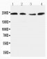 Anti-Nogo A Antibody