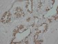 Anti-PKC Alpha Antibody