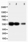 Anti-RAGE Antibody