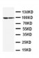 Anti-STAT1 Antibody