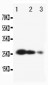 Anti-TIMP-3 Antibody