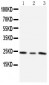 Anti-TIMP-4 Antibody