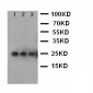 Anti-VEGF Antibody