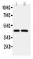 Anti-Caspase-2 Antibody