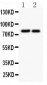 Anti-Gamma Catenin Antibody