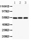 Anti-SLC2A1 Antibody