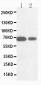 Anti-MMP16 Antibody