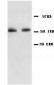 Anti-NF-kB p65 Antibody