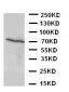 Anti-Estrogen Receptor Beta Antibody