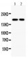 Anti-Topoisomerase II Alpha Antibody