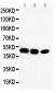 Anti-CCR6 Antibody