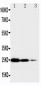 Anti-TNFsR I Antibody