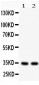 Anti-XAF1 Antibody