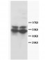 Anti-RUNX2 Antibody