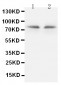 Anti-PKC Gamma Antibody