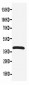 Anti-CXCR4 Antibody