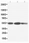 Anti-Cytokeratin 8 Antibody