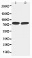 Anti-sTNFsR II Antibody