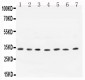 Anti- Cyclin D1 Antibody