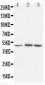 Anti-LXR Alpha Antibody