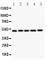 Anti-LXR Alpha Antibody