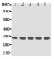 Anti-TFPI2 Antibody