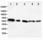 Anti-AKT1/2 Antibody