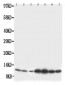 Anti-S100 Beta Antibody