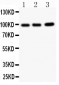 Anti-TNFAIP1 Antibody