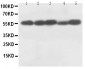 Anti-Caspase-8 (p18) Antibody