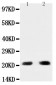 Anti-PUMA Antibody