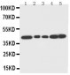 Anti-Decorin Antibody