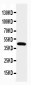 Anti-NPHS2 Antibody