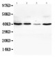 Anti-VEGFD Antibody