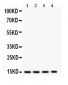 Anti-Cardiac FABP Antibody