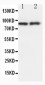 Anti-GRP94 Antibody