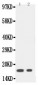 Anti-IL-1 beta Antibody