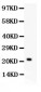 Anti-IL-18 Antibody