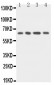 Anti-uPAR Antibody