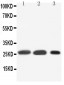 Anti-SFTPA1 Antibody