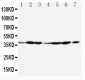 Anti-Annexin A2 Antibody